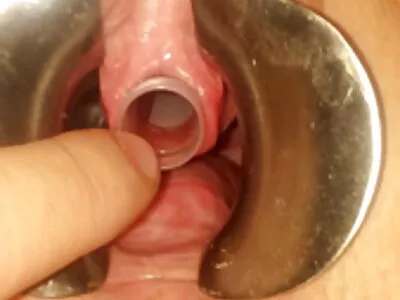 SEXY TEEN kostenlose pornos reife frauen FLASCHE FICKEN